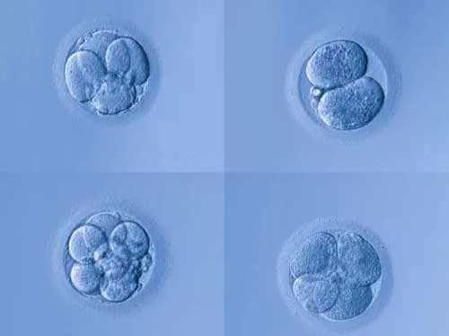 做试管养囊的关键因素？胚胎质量和实验室技术！