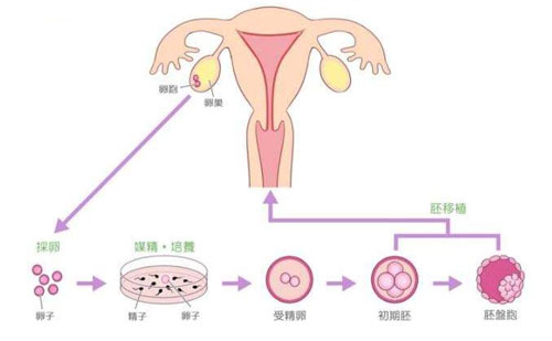 卵子是怎么到子宫的？怎么有助于受精卵到子宫？
