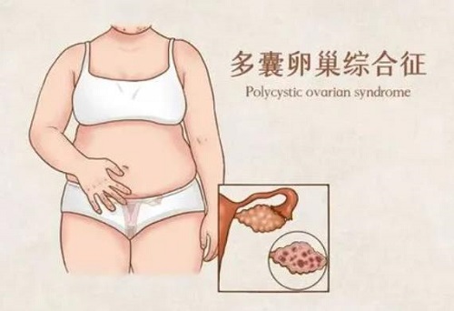上海试管婴儿amh高就一定多囊吗？amh值多少为卵巢早衰？