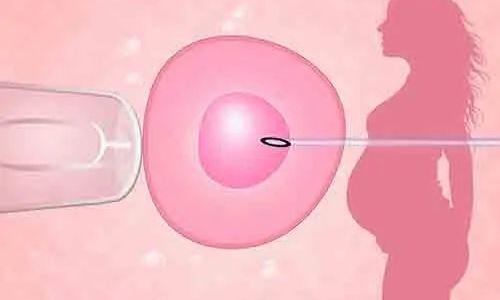 卵巢切除可以做试管吗?一侧卵巢切除可以做试管婴儿么?